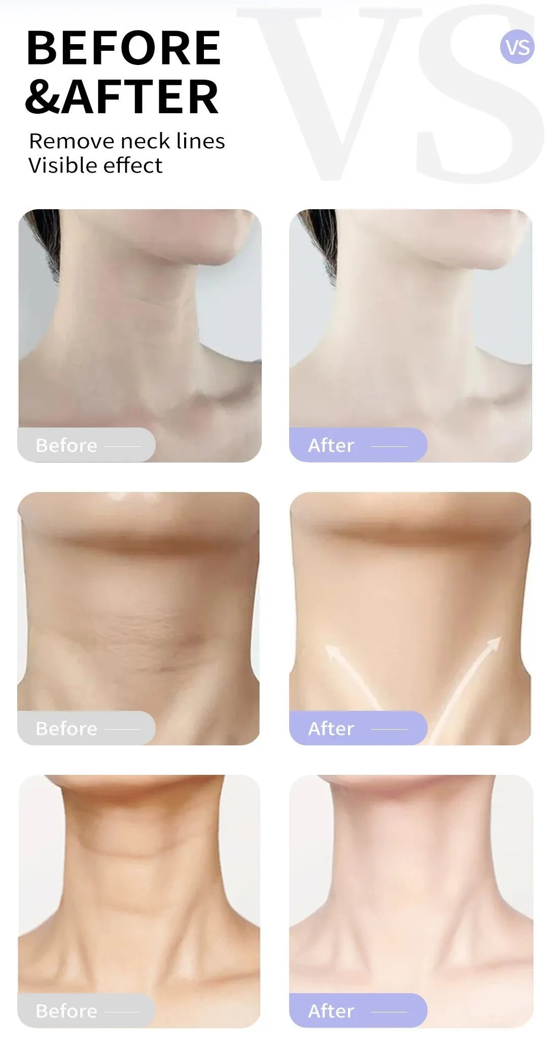 Neck Firming Cream