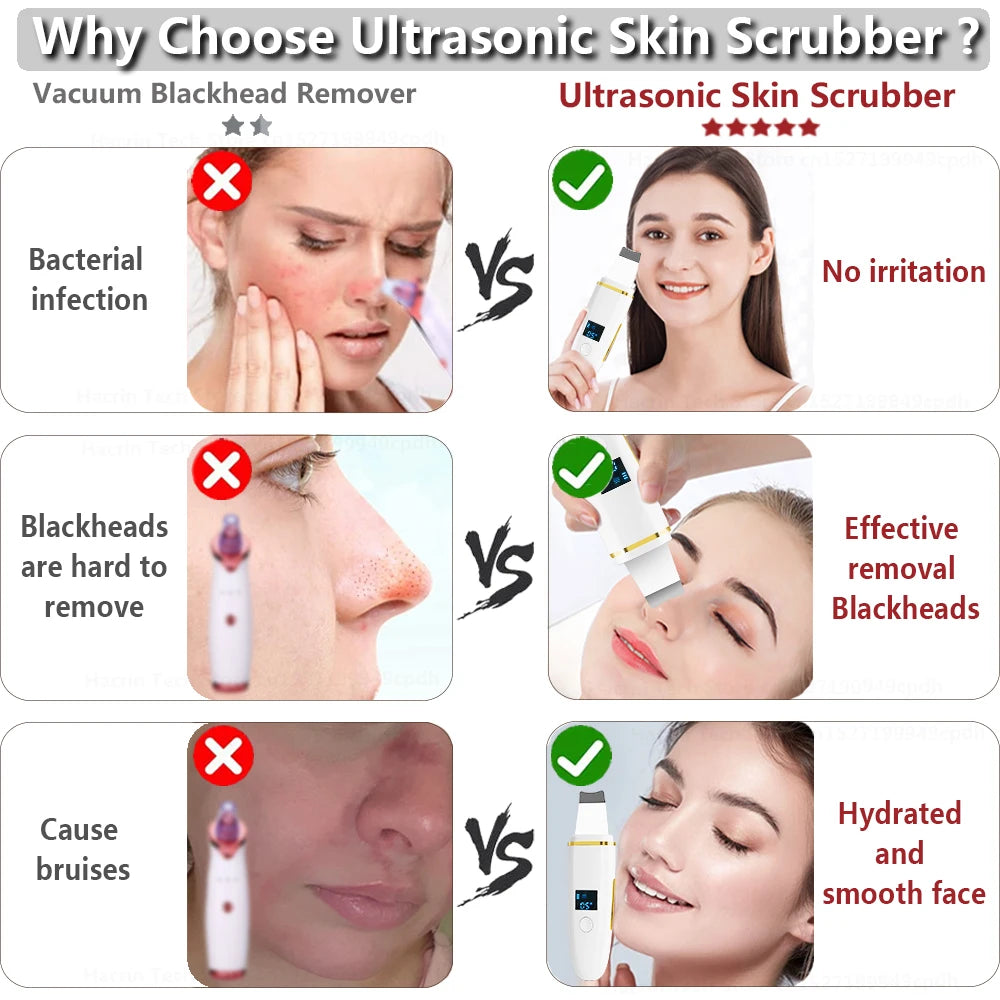 Z9 Ultrasonic Skin Scrubber