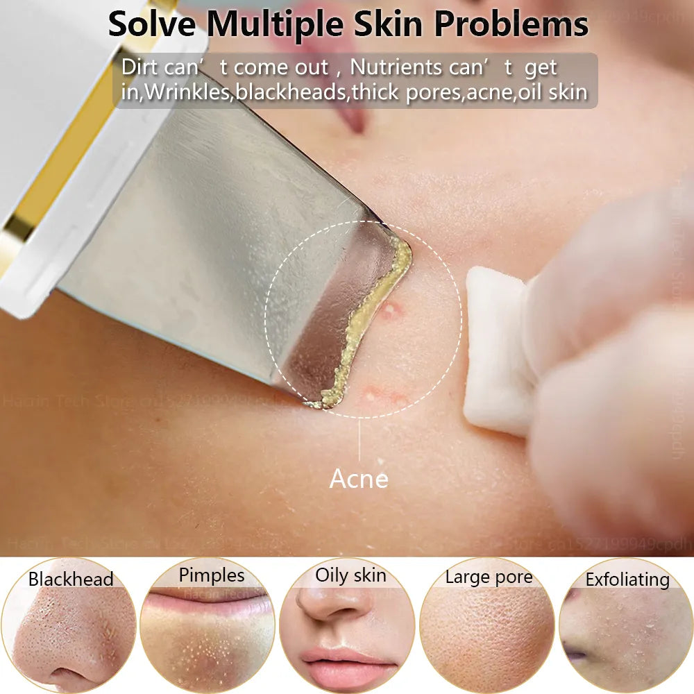 Z9 Ultrasonic Skin Scrubber